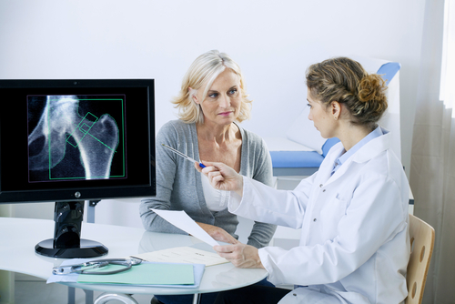 Artrite reumatoide e osteoporosi: identificati i principali fattori di rischio
