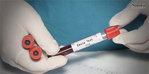 Ebola, oltre mille casi in Congo. OMS: “Il focolaio cresce più rapidamente della capacità di contenerlo”
