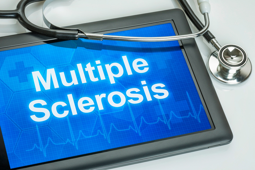 Sclerosi multipla secondariamente progressiva: Commissione Europea approva tolebrutinib