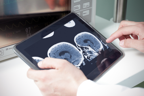 Dispositivi medici, parte il nuovo Programma nazionale Hta 2026-2028. Più valutazioni su acquisti, innovazione e tecnologie obsolete