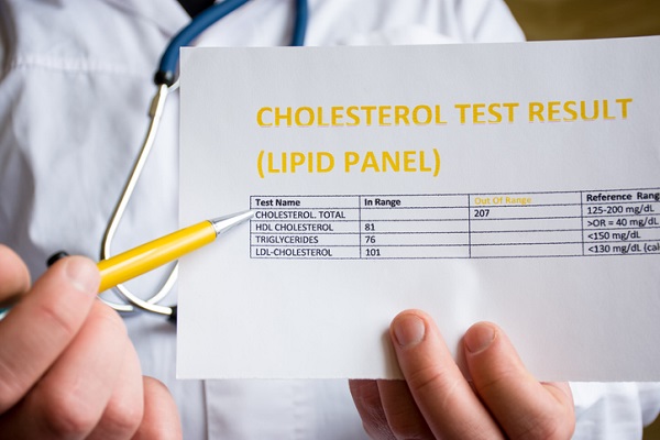 Pleurotus ostreatus: effetti limitati sull’LDL-C ma possibili benefici sul metabolismo
