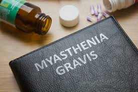 Miastenia grave: studio sulla terapia con cellule T CAR a mRNA dirette contro BCMA