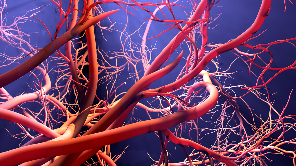 Adipochine e rimodellamento nell’aneurisma dell’aorta addominale