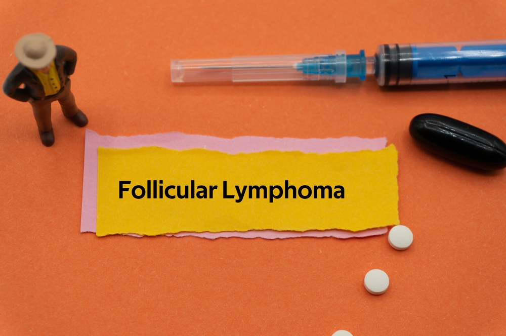 Linfoma follicolare POD24: trattamento e risultati di sopravvivenza 