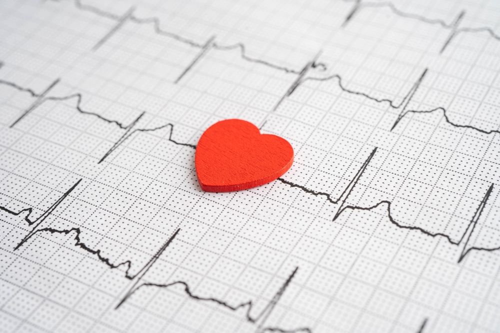 Mappatura ad alta risoluzione individua tachicardia atriale focale da vena cava superiore