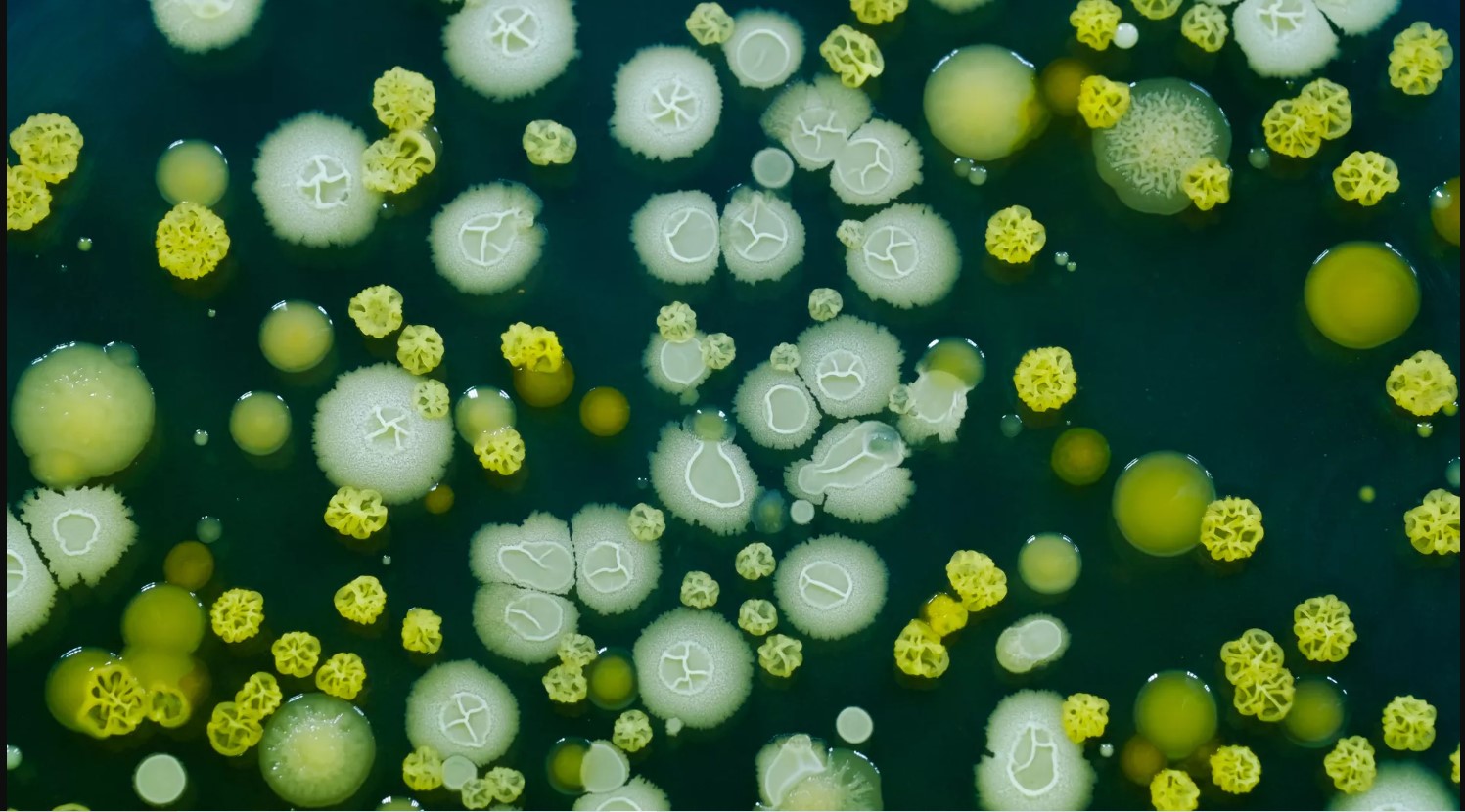 Infezioni da batteri Kluyvera nell’uomo: revisione sistematica