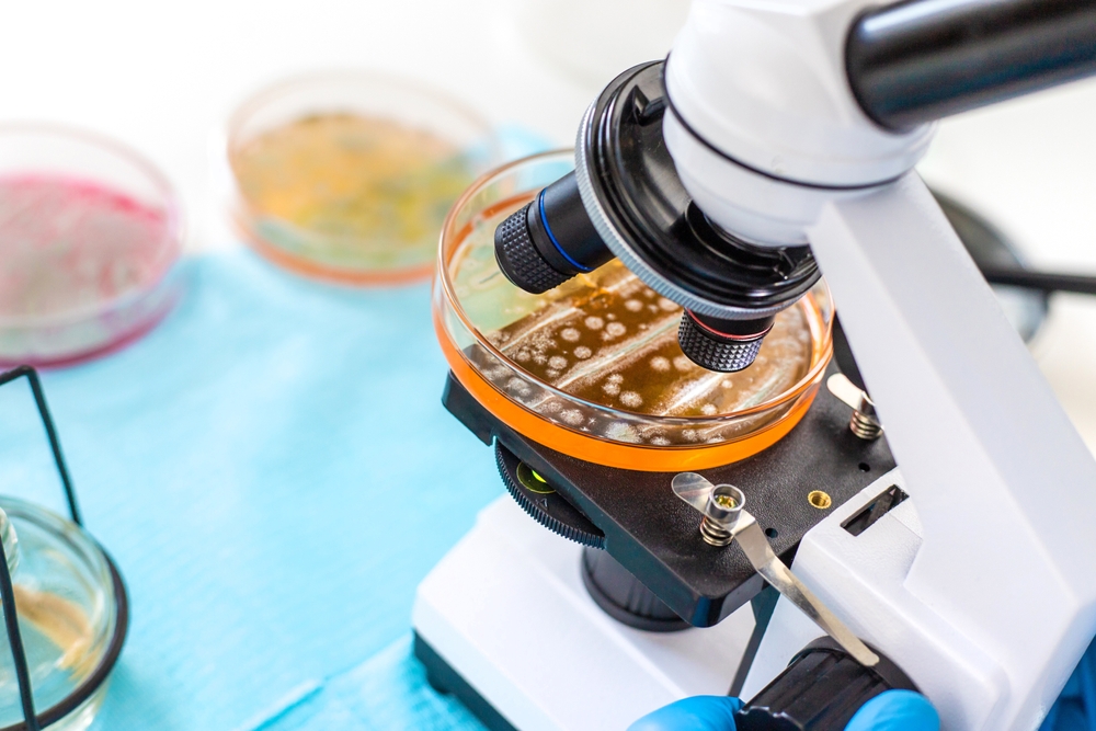 Nuovi batteri contro infezioni intestinali da Clostridioides difficile: efficacia pari a trapianto fecale