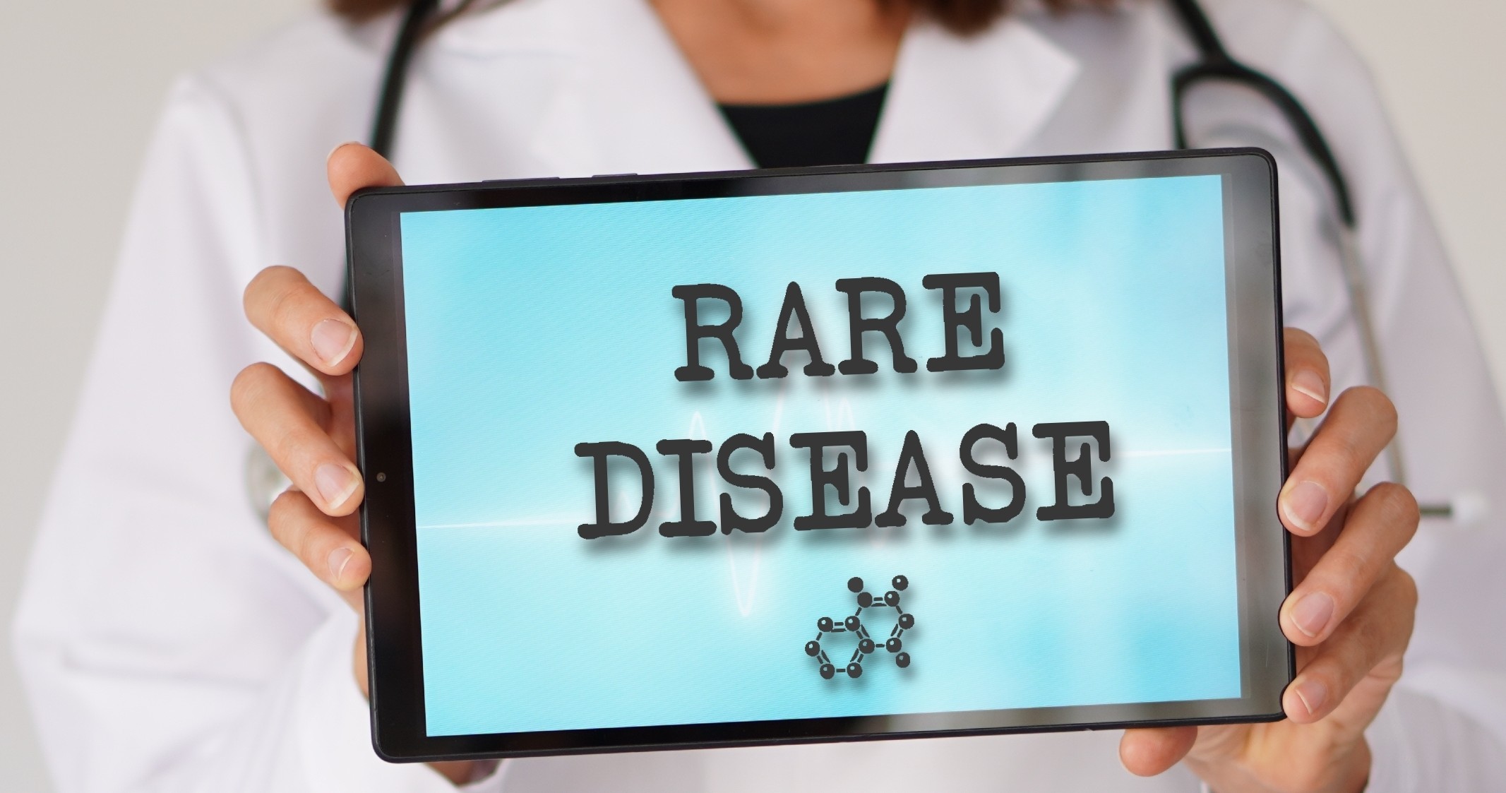 Malattie rare. Efpia: “Serve un Piano d’Azione Ue”. Quattro priorità per accelerare ricerca, diagnosi e accesso alle cure