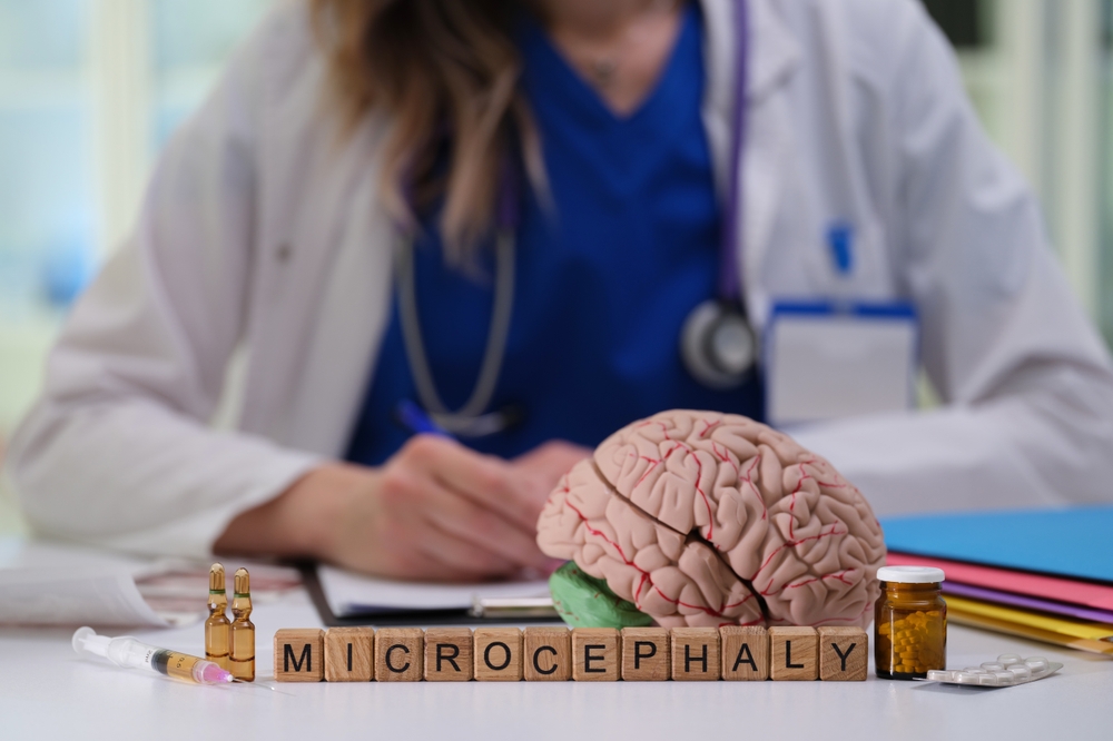 Microcefalia, nuova scoperta su 2 geni: perché il cervello non si sviluppa correttamente