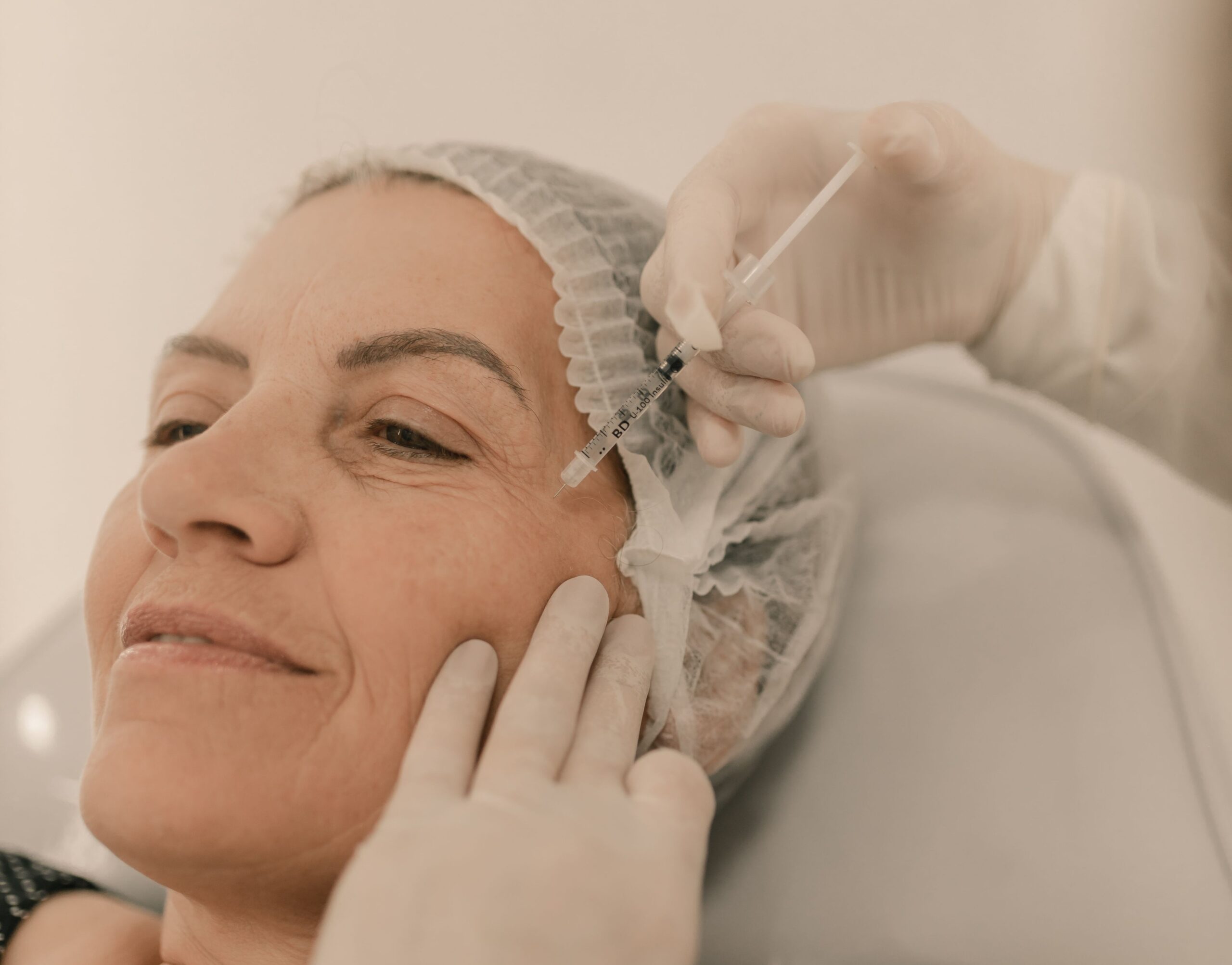 Rughe, una terapia ottenuta dalle cellule del paziente funziona meglio dell’acido ialuronico