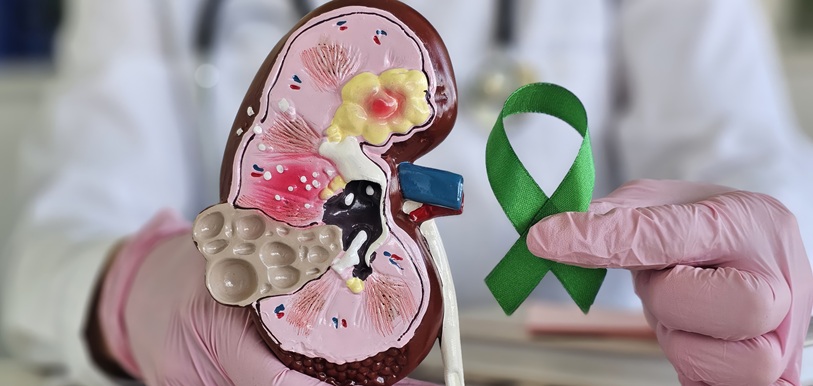 Tumore del rene, il benessere emotivo entra nel percorso oncologico