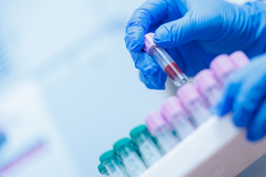 Un esame del sangue rivela l’età biologica degli organi