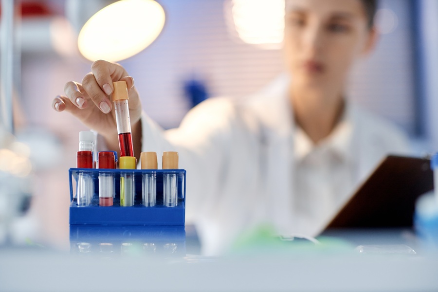 Un prelievo può svelare quali cellule stanno invecchiando più in fretta