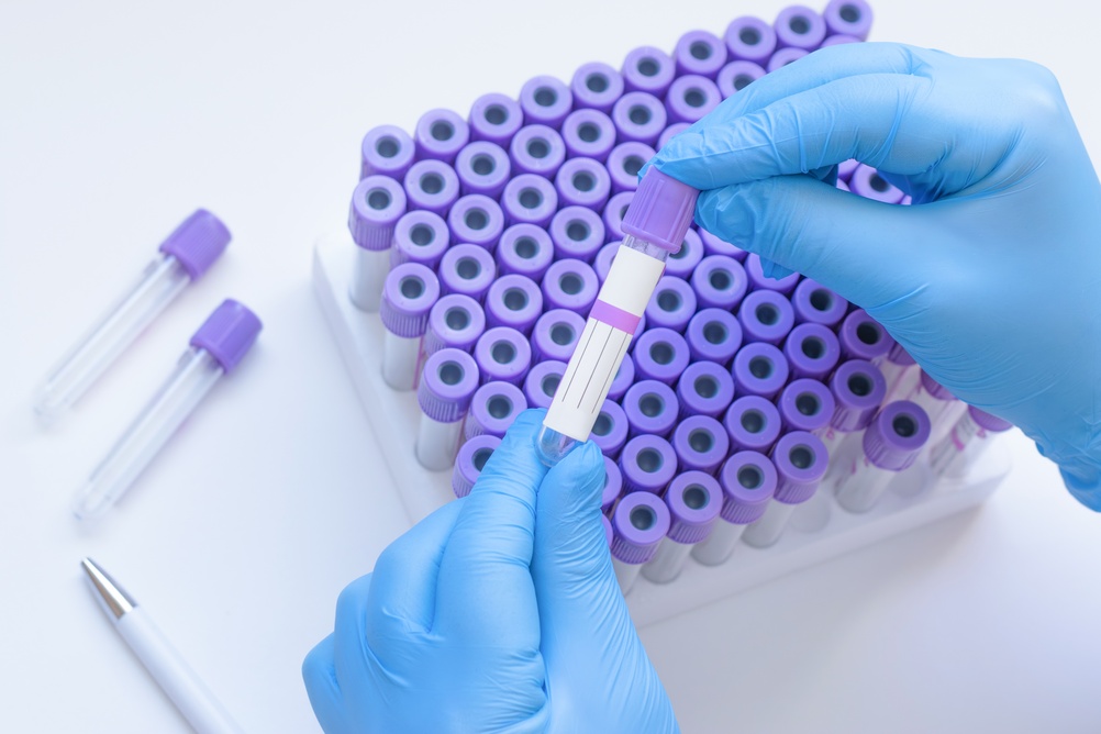 Autismo, test sul sangue con IA al 93,2% di precisione: svolta per diagnosi precoce nei bambini