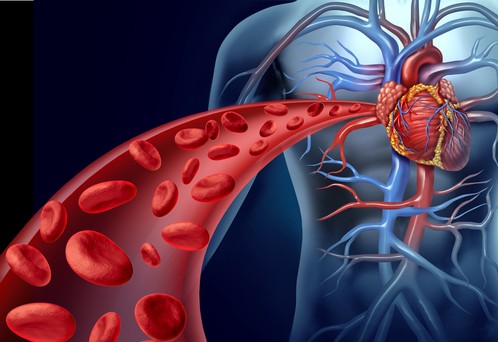 Infarto, nei pazienti colpiti più microplastiche nel sangue delle coronarie