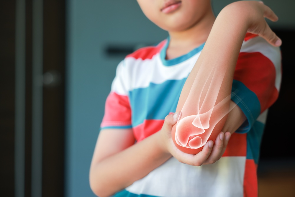 Bambino Gesù: 20 mila traumi pediatrici ogni anno, oltre 8 mila sono fratture
