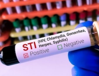 Gonorrea. L’Ecdc lancia l’allarme: aumentano in Europa i ceppi resistenti al principale antibiotico