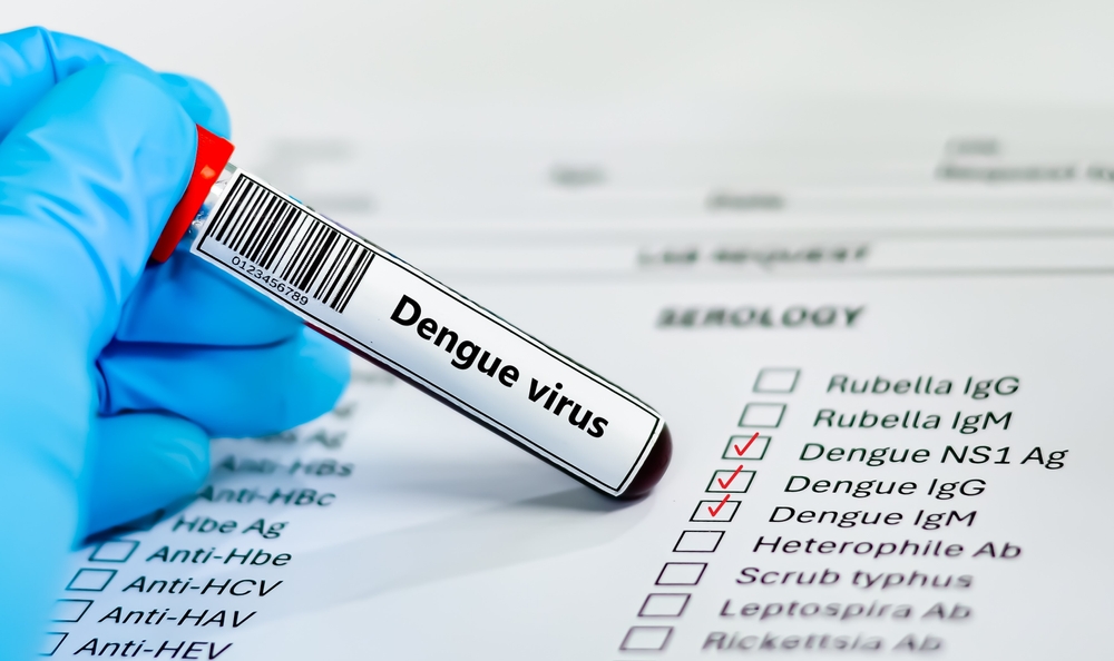 Dengue, studio Iss-Fbk: nei focolai italiani il contagio resta quasi sempre entro 400 metri. Fondamentali diagnosi precoce e disinfestazione