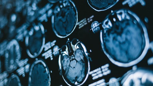 Da Sirm e Aiom le raccomandazioni per la tomografia computerizzata, sono le prime in Europa