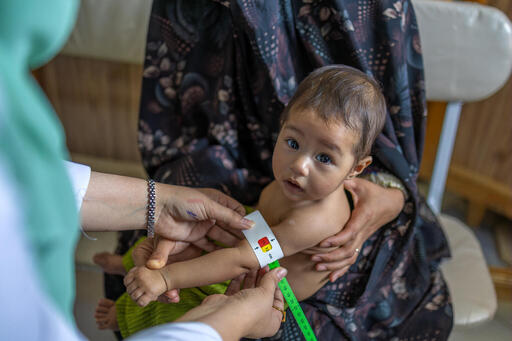 Malnutrizione, UNICEF: in Afghanistan a rischio 3,7 milioni di bambini sotto i cinque anni